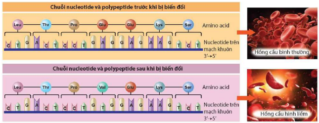 Đột biến gene gây bệnh thiếu máu hồng cầu hình liềm