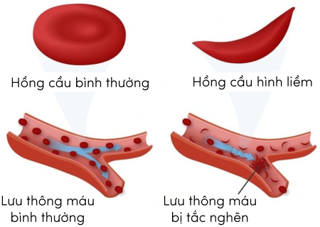 Đột biến gene olm