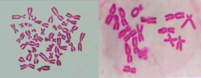 Khoa học tự nhiên 9, tiêu bản nhiễm sắc thể olm
