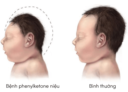 khoa học tự nhiên 9, đột biến gene, olm