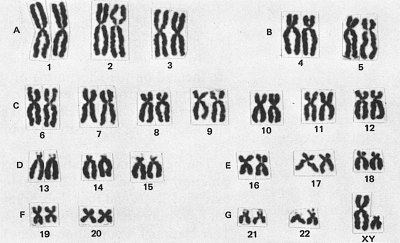 sinh học 12, bộ NST nam ở người