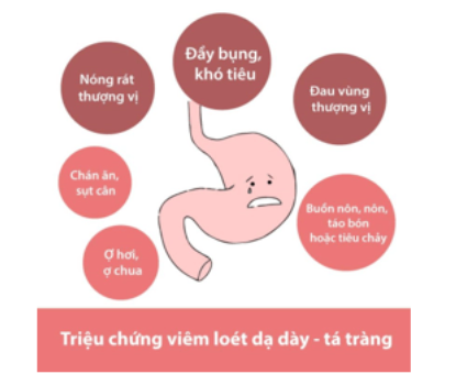 Một số triệu trừng viêm loét dạ dày - tá tràng